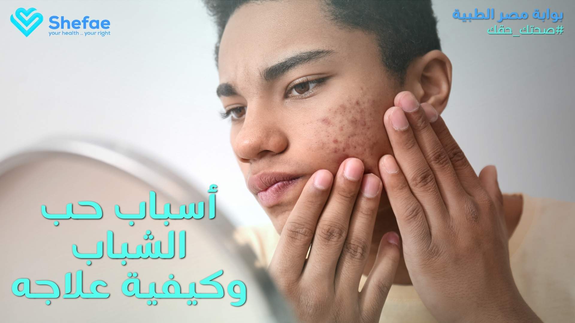أسباب حب الشباب وطرق العلاج