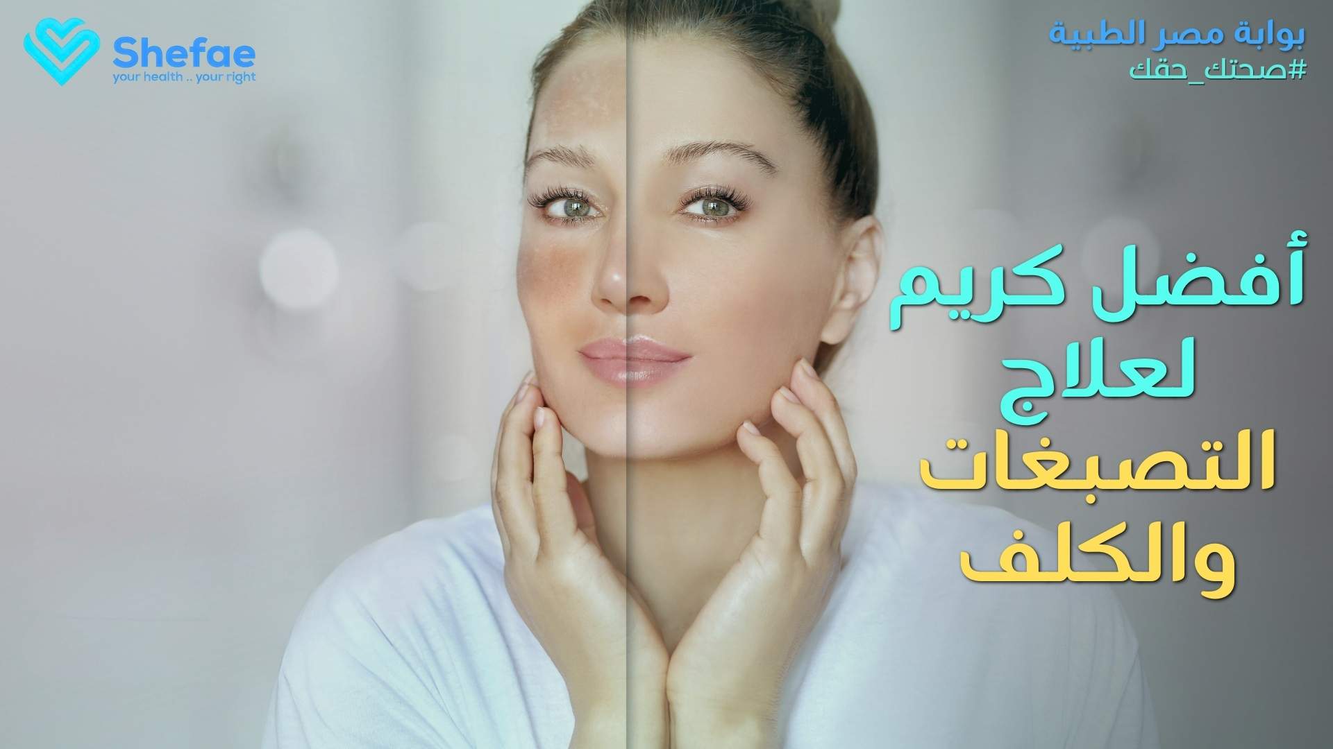 علاج الكلف وأفضل طرق تفتيح البشرة