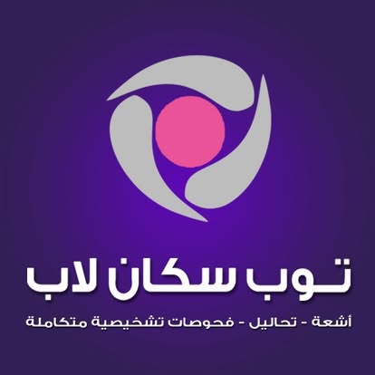 مركز توب سكان مدينة نصر